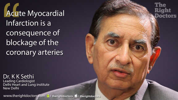 MI is a consequence of blocked coronary arteries — a crucial reminder from Dr. KK Sethi.