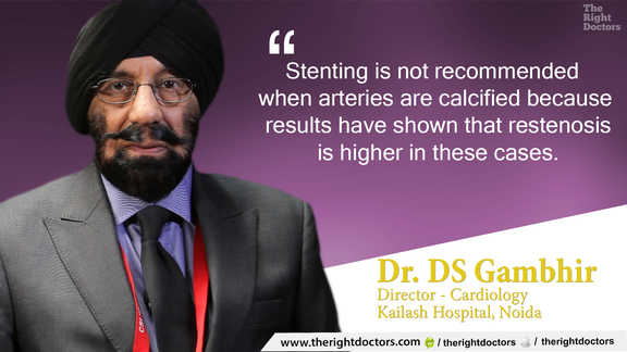Restenosis is higher when stenting is done for calcified arteries — clinicians should take note.