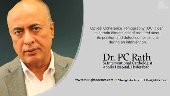 OCT can provide accurate dimensions and position of stent — Dr. PC Rath explains why this matters.