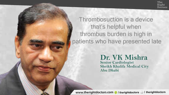 Thrombosuction is a device used when thrombus burden is high — clinicians should take note.