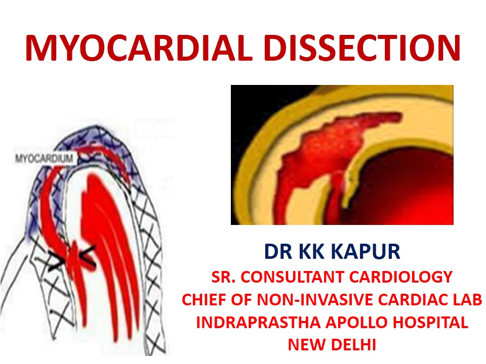 dr-k-k-kapur-myocardial-dissection