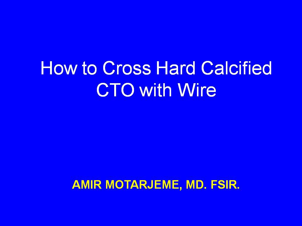 dr-amir-motarjeme-how-to-cross-hard-calcified-cto-with-wire